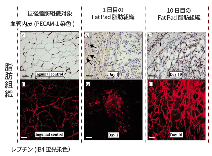 脂肪組織に対する血管新生とレプチンの関係