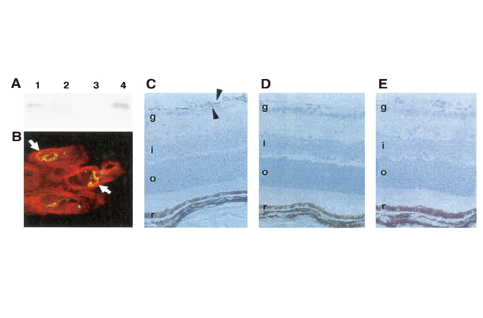 レプチンは虚血誘発性網膜血管新生を刺激する