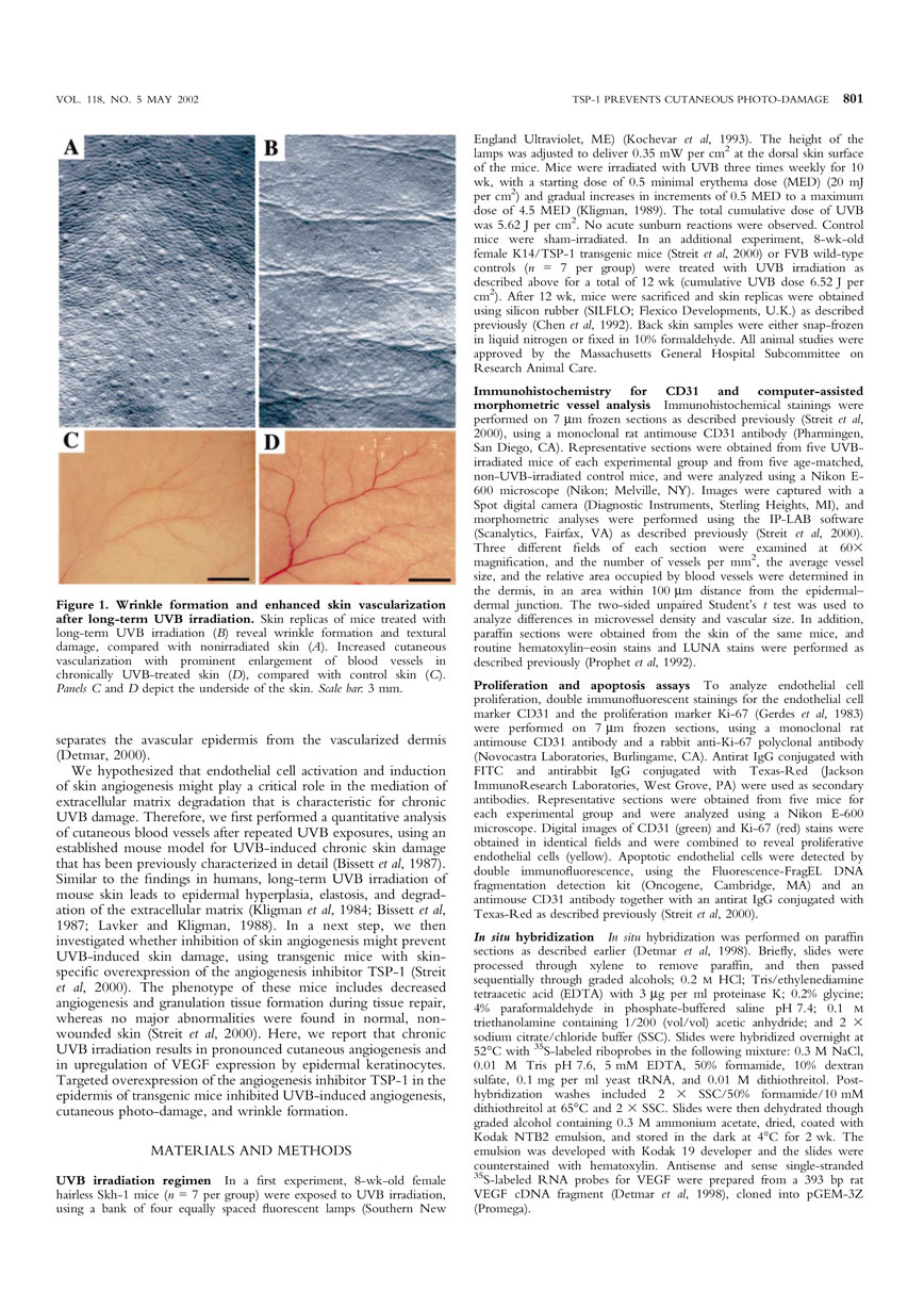 Targeted Overexpression of the Angiogenesis Inhibitor in the Epidermis Prevents Ultraviolet-B-Induced Angiogenesis and Cutaneous Photo-Damage P2