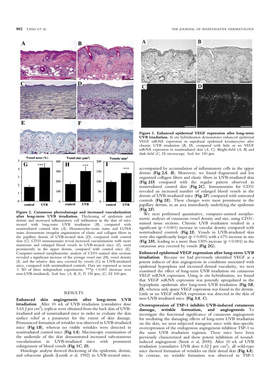 Targeted Overexpression of the Angiogenesis Inhibitor in the Epidermis Prevents Ultraviolet-B-Induced Angiogenesis and Cutaneous Photo-Damage P3