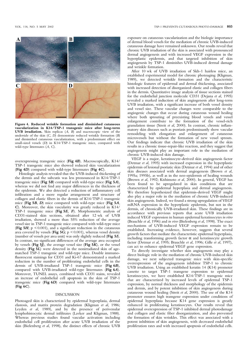 Targeted Overexpression of the Angiogenesis Inhibitor in the Epidermis Prevents Ultraviolet-B-Induced Angiogenesis and Cutaneous Photo-Damage P4