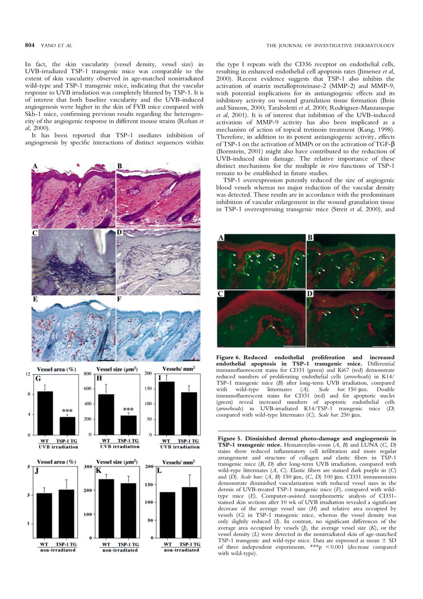 Targeted Overexpression of the Angiogenesis Inhibitor in the Epidermis Prevents Ultraviolet-B-Induced Angiogenesis and Cutaneous Photo-Damage P5
