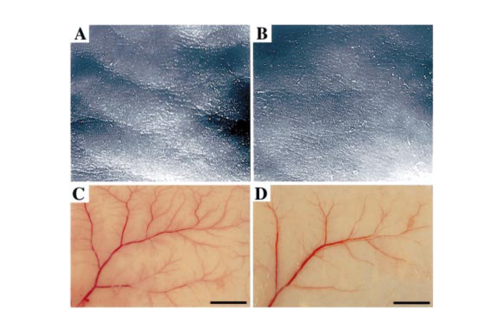 Targeted Overexpression of the Angiogenesis Inhibitor in the Epidermis Prevents Ultraviolet-B-Induced Angiogenesis and Cutaneous Photo-Damage