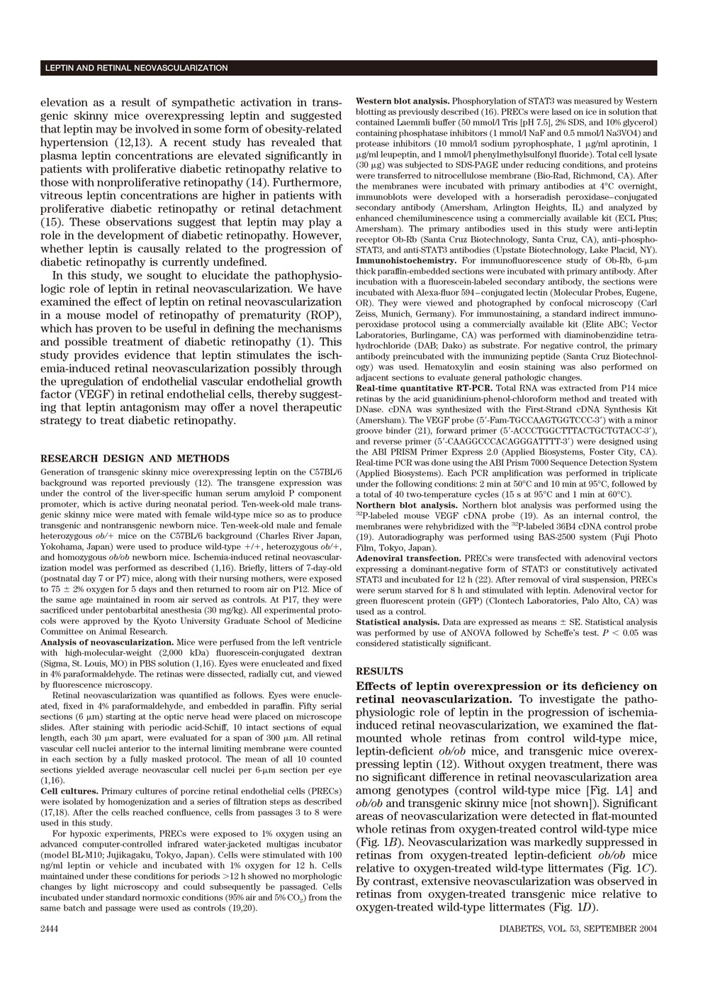 Leptin Stimulates Ischemia-Induced Retinal Neovascularization P2