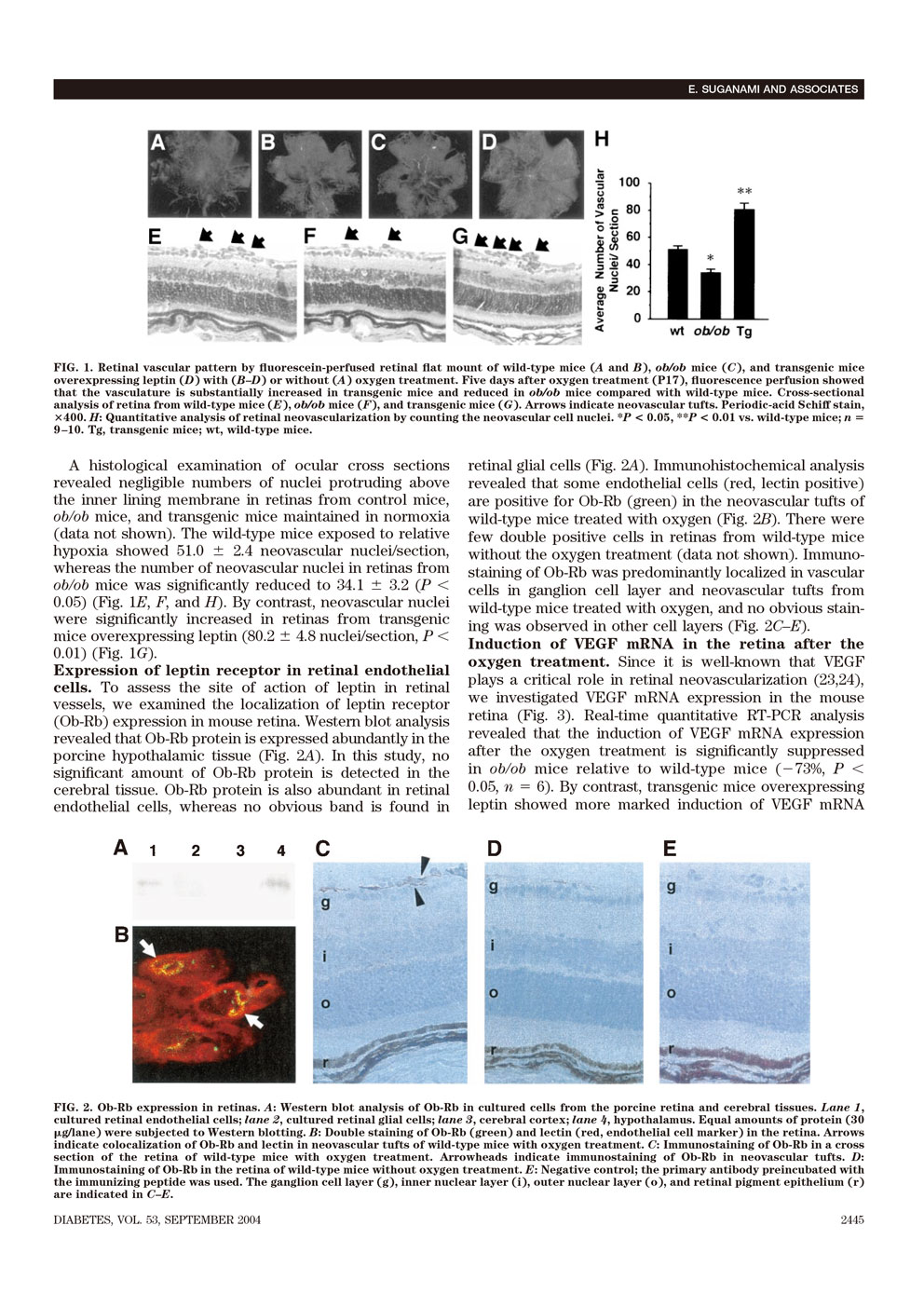 Leptin Stimulates Ischemia-Induced Retinal Neovascularization P3