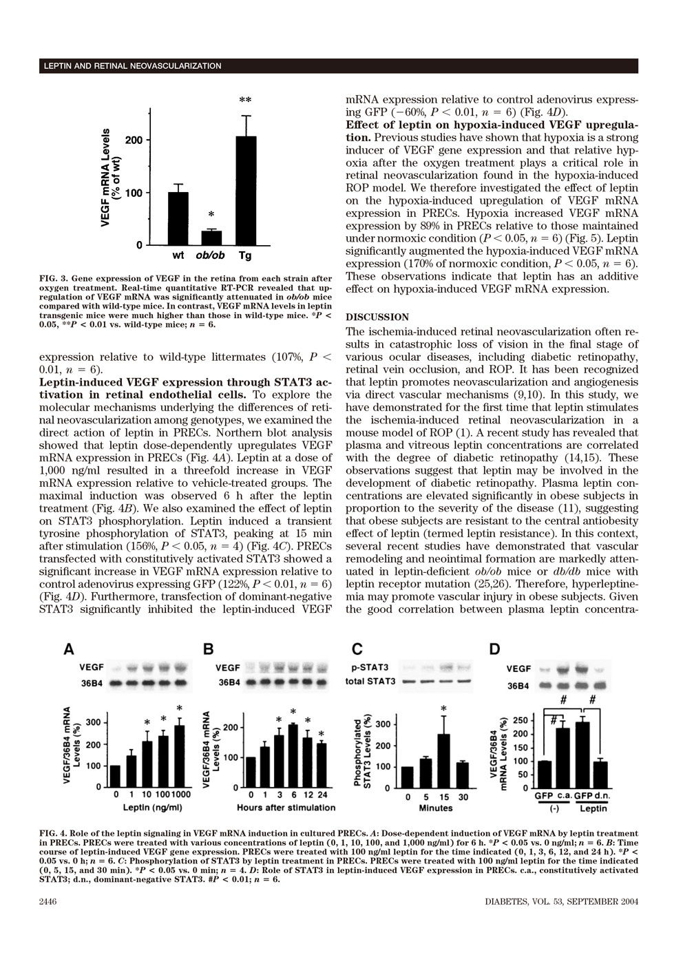 Leptin Stimulates Ischemia-Induced Retinal Neovascularization P4