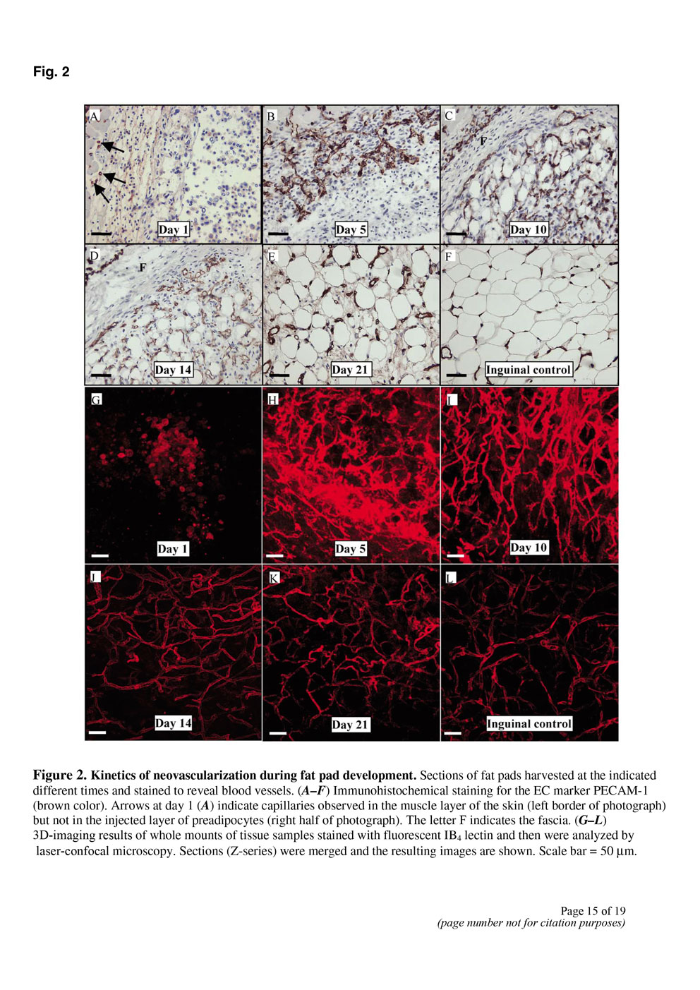 Angiogenesis in an in vivo model of adipose tissue development P15