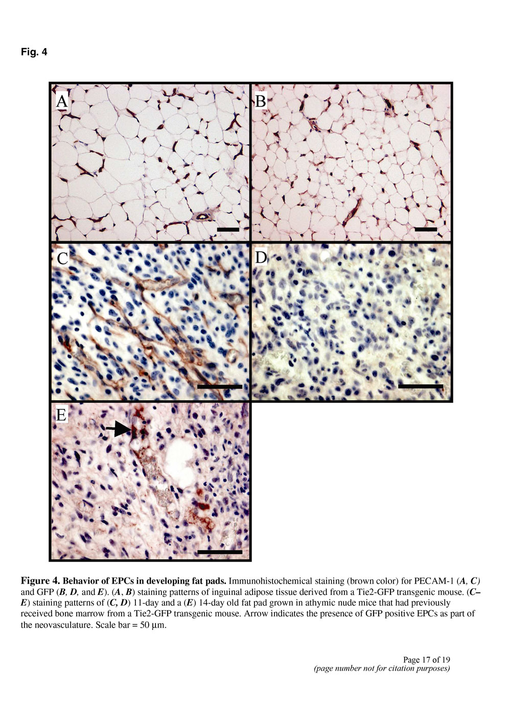 Angiogenesis in an in vivo model of adipose tissue development P17
