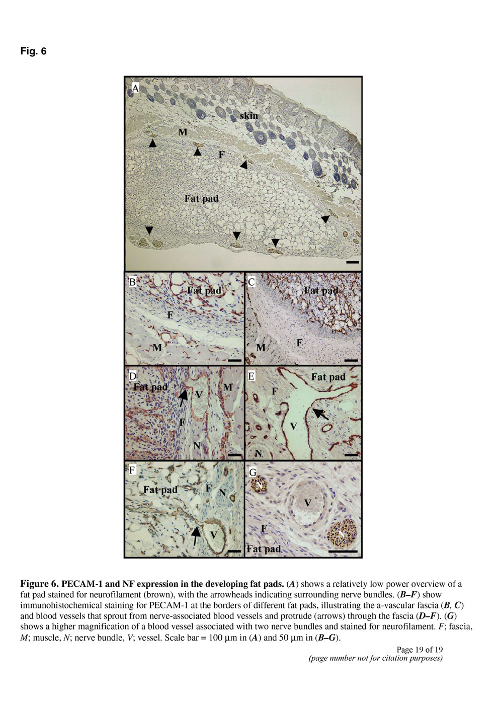 Angiogenesis in an in vivo model of adipose tissue development P19