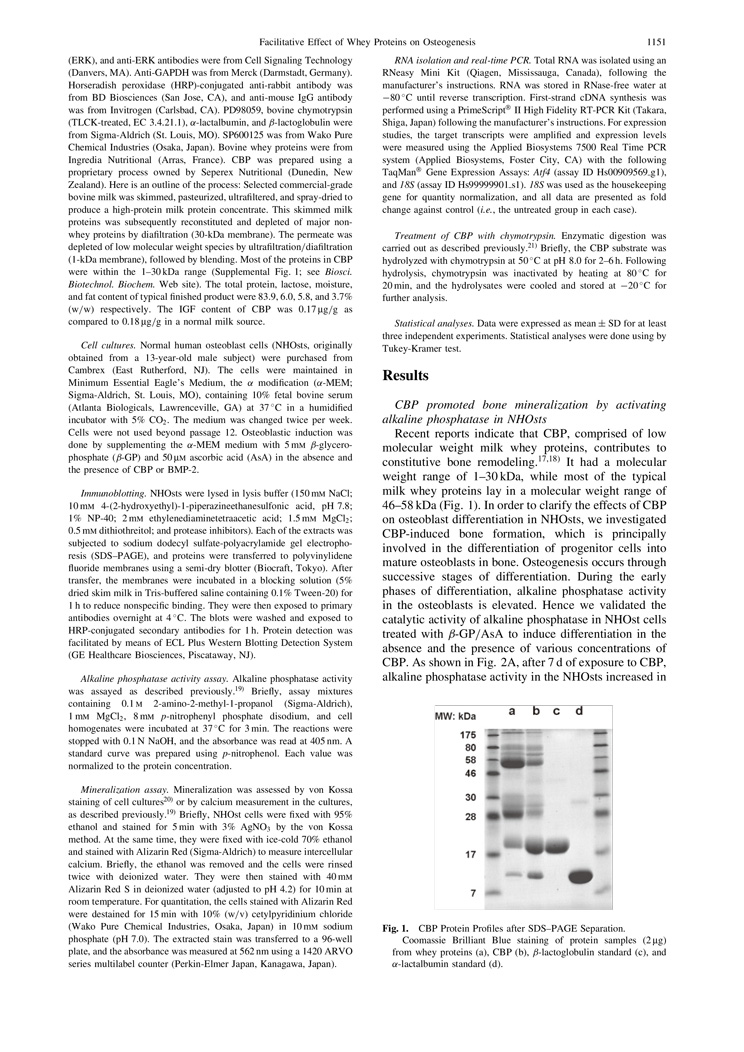 CBP Facilitate Osteogenesis through Activation of the JNK-ATF4 Pathway P2